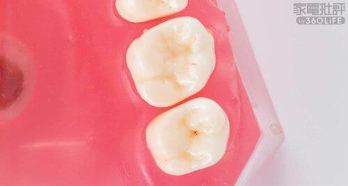 After 安い電動歯ブラシおすすめ イメージ