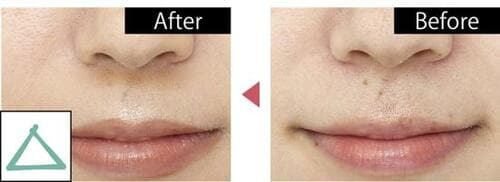 ハイライト部分が惜しい イメージ