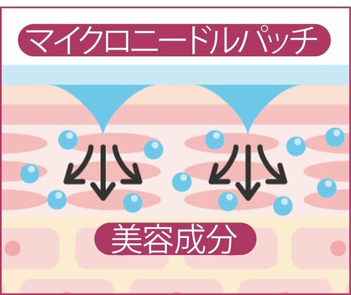 貼るとき細かい針がちょっと痛いけど、即効性は期待できる! イメージ2
