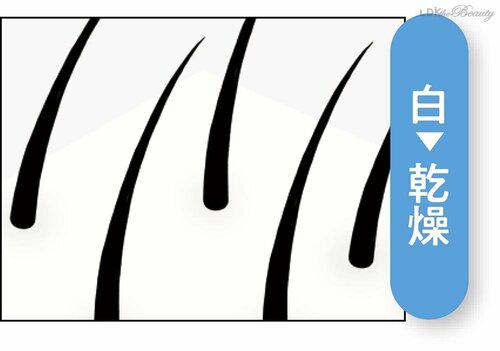 頭皮の色が髪の健康バロメーター イメージ2