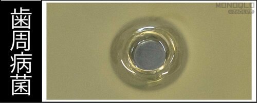 抗菌力のテストで高評価! 歯磨き粉おすすめ イメージ2