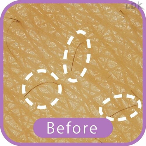 Before VIOシェーバーおすすめ イメージ
