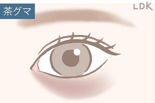 茶クマ対策アイクリームって? 茶クマ予防アイクリームおすすめ イメージ