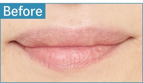 黄み肌／厚め唇 色つきリップクリームおすすめ イメージ