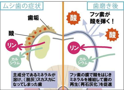 選び方1:虫歯予防成分が入っているものを選ぶ 歯磨き粉おすすめ イメージ