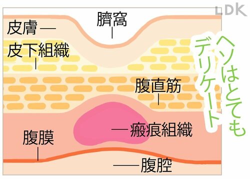 ヘソゴマはパックでスルッと汚れをとる ヘソゴマパックおすすめ イメージ
