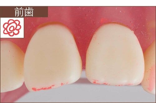 汚れ落ち：評価A＋ イメージ2