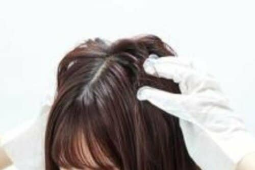手袋シートタイプのドライシャンプーを使う女性の画像