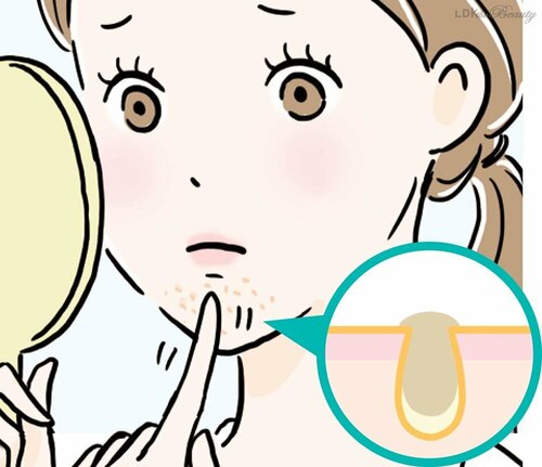 【詰まり毛穴】角栓が詰まってプツプツザラザラ SNSでバズった毛穴ケアおすすめ イメージ