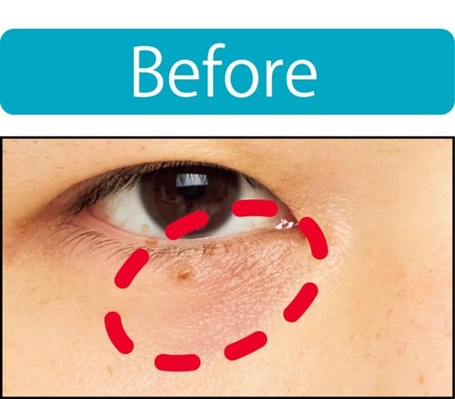 【クマ隠し】肌になじんで自然に隠せた! メンズコンシーラーおすすめ イメージ