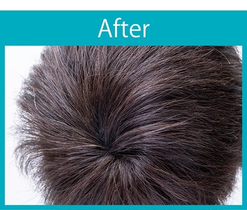 【仕上がり】根元部分がリアル 増毛パウダーおすすめ イメージ2