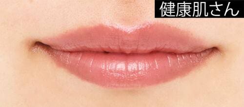 健康肌さん ソフトマットリップおすすめ イメージ
