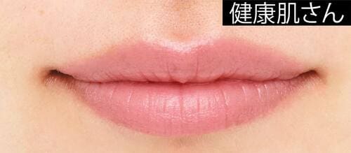 健康肌さん ソフトマットリップおすすめ イメージ