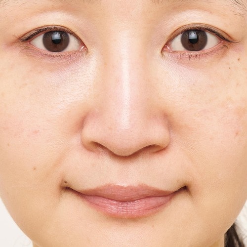 Before プロ直伝の美肌テクおすすめ イメージ