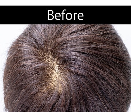 【仕上がり】根元部分がリアル 増毛パウダーおすすめ イメージ