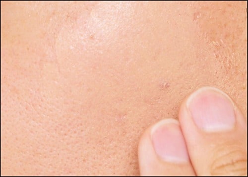 【使い心地】伸びがよくテクニックいらず! メンズコンシーラーおすすめ イメージ