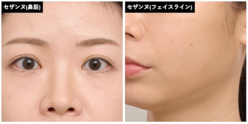 自然な色味で似合いやすい シェーディングおすすめ イメージ