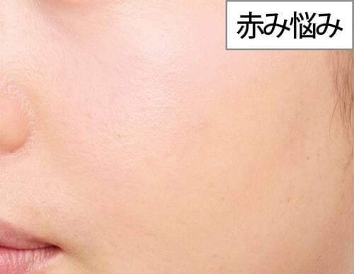 赤み悩みの仕上がり コンシーラーチークおすすめ イメージ