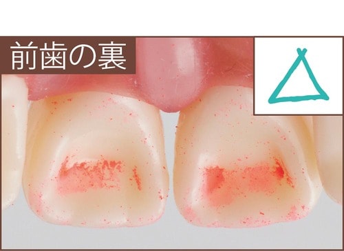 汚れ落ち：評価B イメージ2