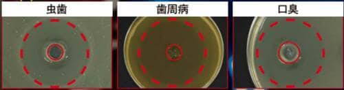 虫歯・歯周病・口臭の原因菌に高い抗菌力を発揮 歯磨き粉のおすすめおすすめ イメージ3