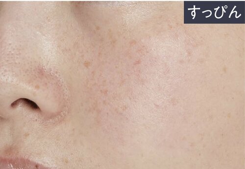 【ベストのワケ】頬や小鼻の赤みを抑えた! イメージ