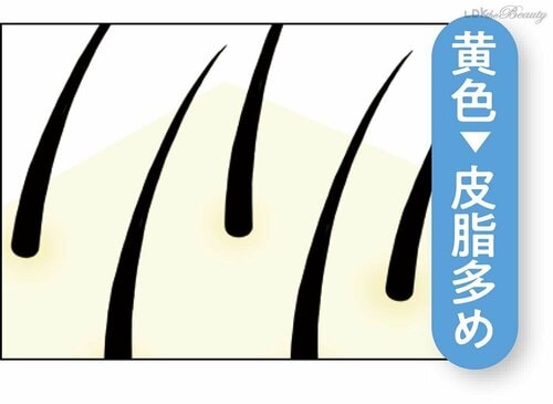 頭皮の色が髪の健康バロメーター イメージ3