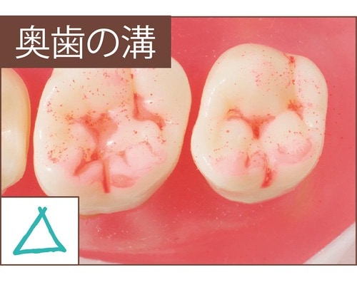 汚れ落ち:評価C こども用電動歯ブラシおすすめ イメージ2