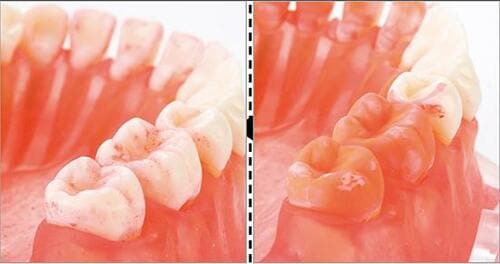 「ながら磨き」のオトモは 軽い・疲れない・高性能 イメージ3