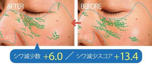 テスト1:しわ目立ち度