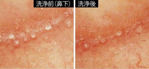 鼻下 洗顔料おすすめ イメージ