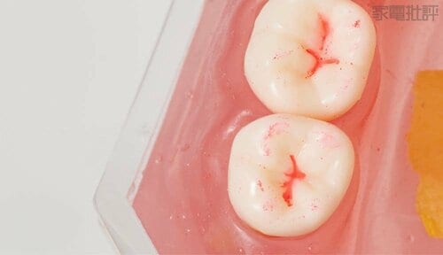 奥歯の溝 電動歯ブラシおすすめ イメージ2