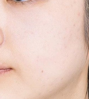 エクセルのみ チークおすすめ イメージ