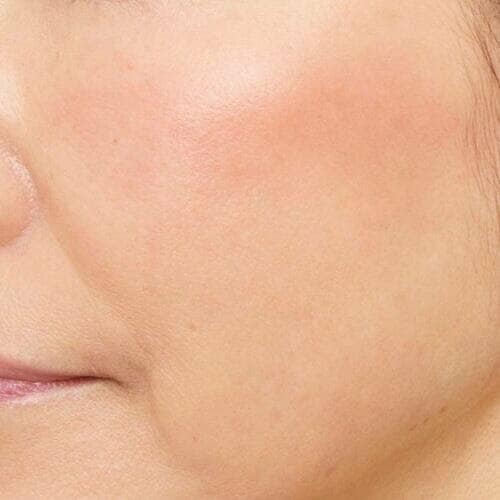 みずみずしいツヤで頬をキュッと上げて見せる 50代60代向けチークおすすめ イメージ