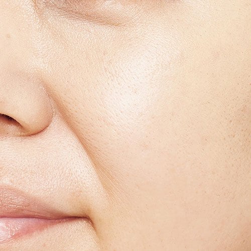 紫で頬の赤みはカバー コンシーラーおすすめ イメージ