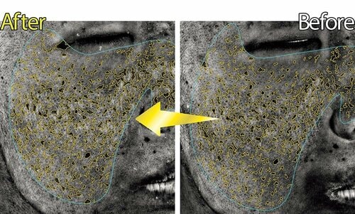シミケア度:飛び抜けた減少値でしっかり効果を発揮!