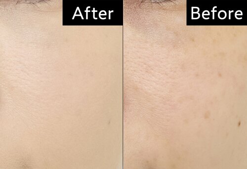 気になるシミや毛穴を隠せるカバー力もポイント BBクリームおすすめ イメージ