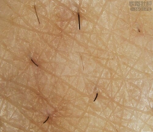 肌へ平行に当てると痛みは感じない メンズボディシェーバーおすすめ イメージ