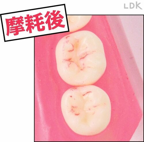 汚れ落ちの変化：摩耗後 歯ブラシおすすめ イメージ