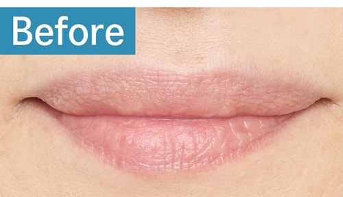 黄み肌／厚め唇 色つきリップクリームおすすめ イメージ