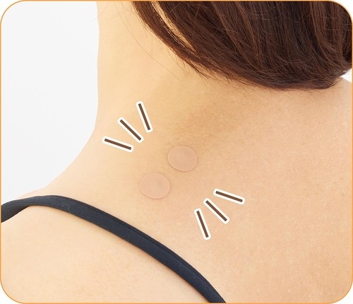 コリや痛いところにダイレクトに貼ってOK！ 鍼シールおすすめ イメージ