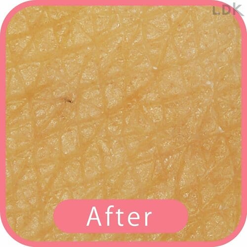 After 女性用T字カミソリおすすめ イメージ