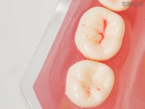 奥歯の溝 電動歯ブラシおすすめ イメージ2