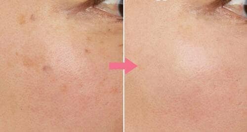 Before→After パレットコンシーラーおすすめ イメージ