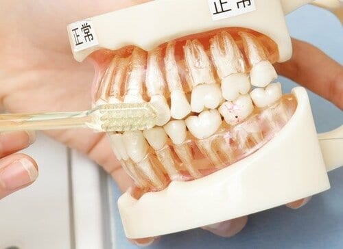 絶対に意識してほしい2カ所をこうやって磨くのがプロの技!