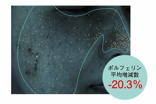余分な皮脂をしっかり除去 イメージ