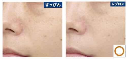 肌補整力 トーンアップ下地おすすめ イメージ