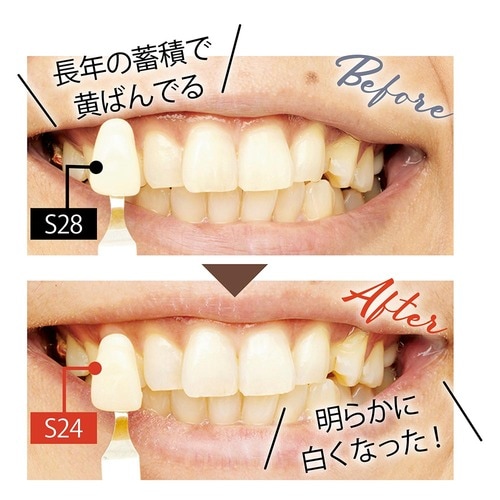 ベスコスの理由：短期間で白さを実感 イメージ