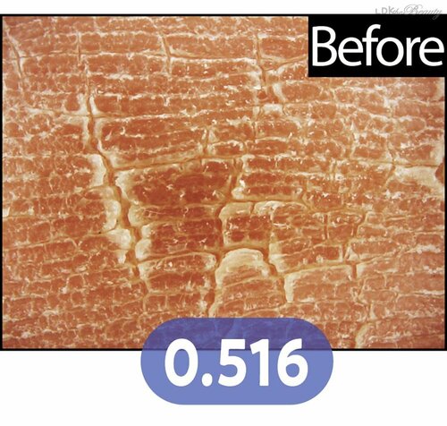 Before ボディスクラブおすすめ イメージ