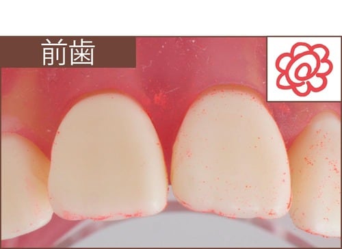 汚れ落ち：評価A イメージ