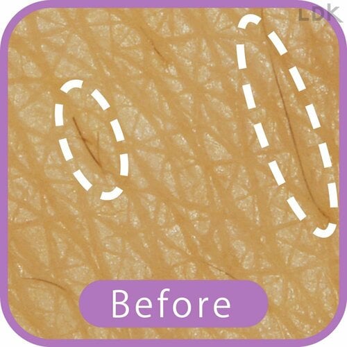 Before VIOシェーバーおすすめ イメージ